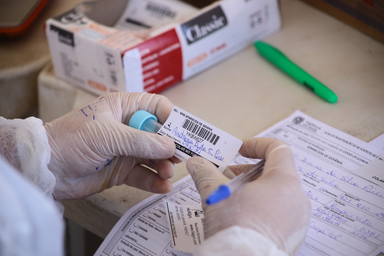 Covid: Saúde mantém testagem em oito postos de Aparecida
